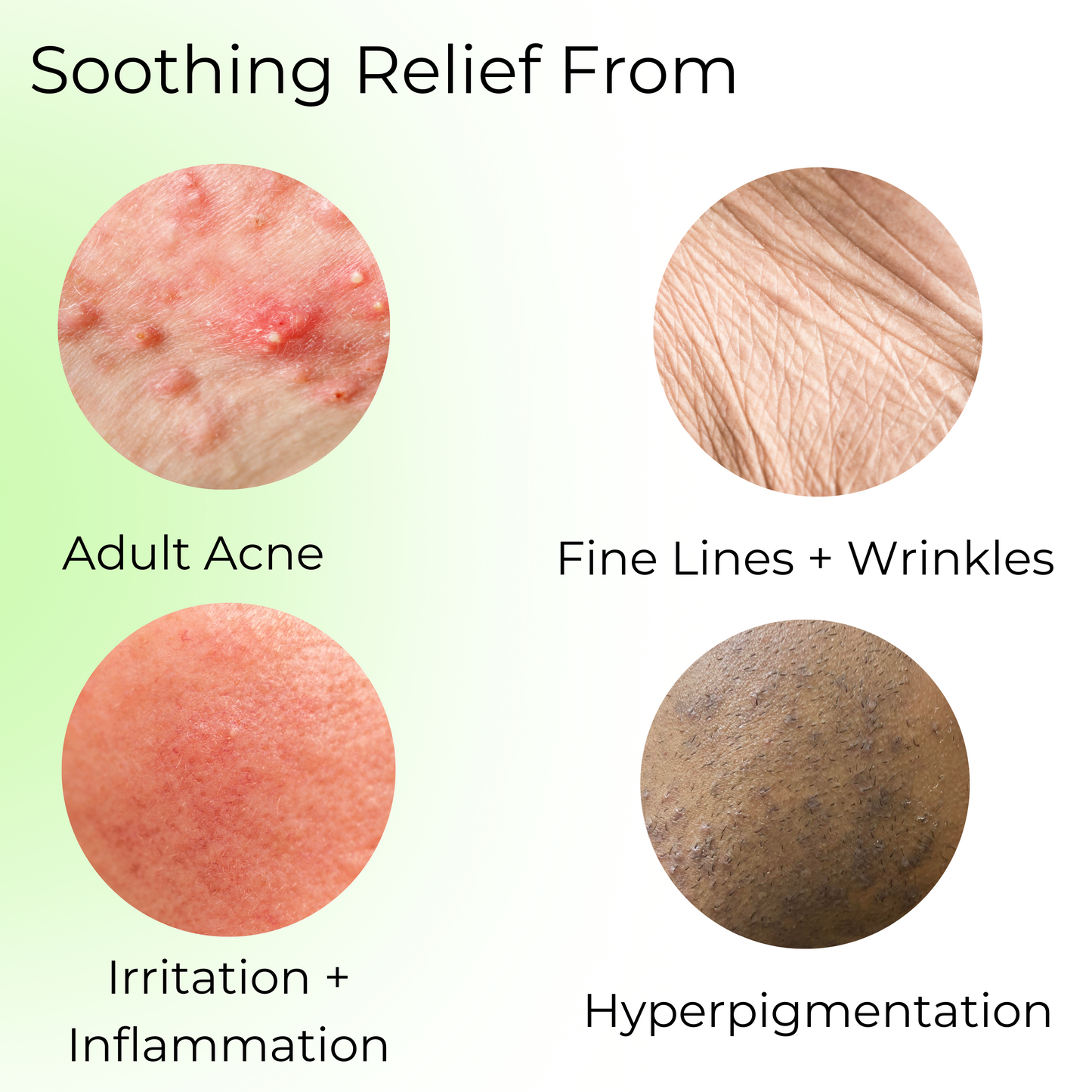 Soothing Relief From: Adult Acne, Fine lines and Wrinkles, Irritation and Inflammation, hyperpigmentation.
