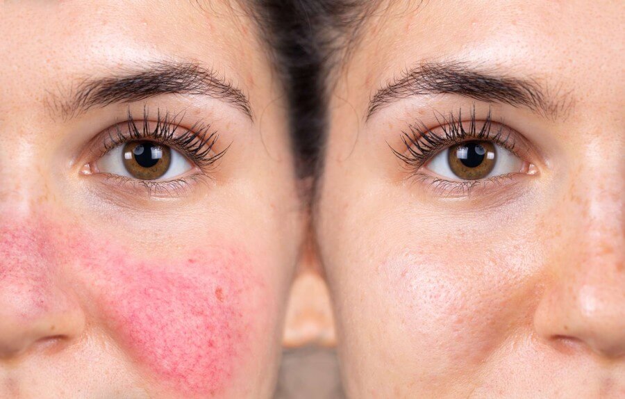 Silent Barrier Burnout: The Hidden Skin Stress Aging You Faster Than You Realize