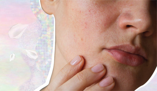 The Skin Shame No One Mentions