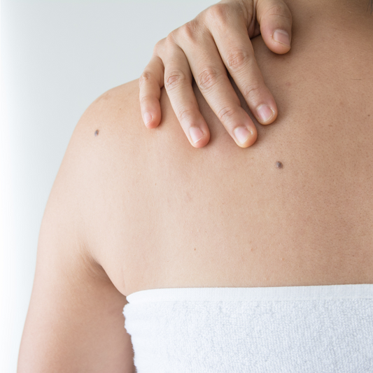 Understanding Post-Cancer Skin Sensitivity | Gleem Skincare