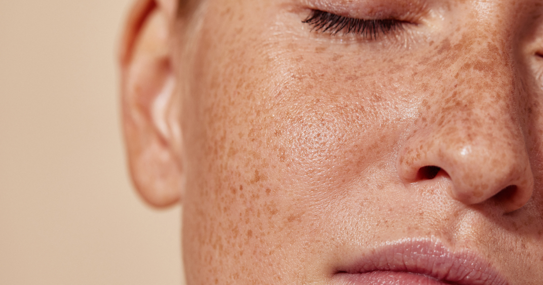 Radiation Skin vs. Barrier Damage: What’s Similar — and What’s Different?