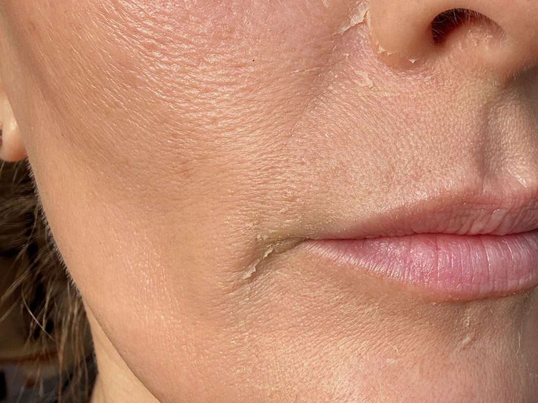 Slow Cell Turnover Post-Chemo — The “Quiet Skin” Effect