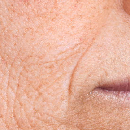 Close-up of improved complexion.