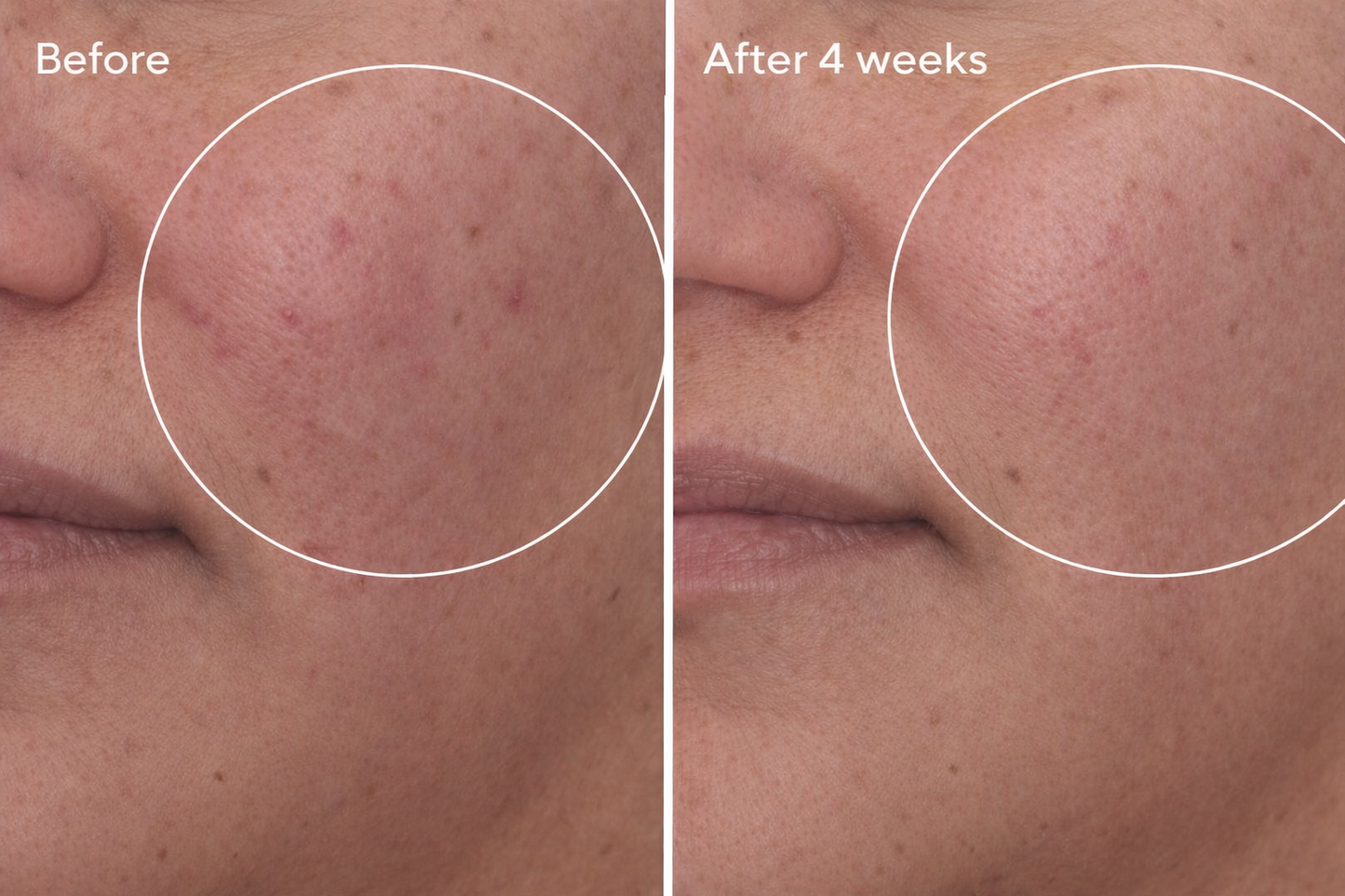 Soft Immersion Night Moisturizer | Barrier Repair Hydration | Gleem Skincare