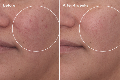 Soft Immersion Night Moisturizer | Barrier Repair Hydration | Gleem Skincare